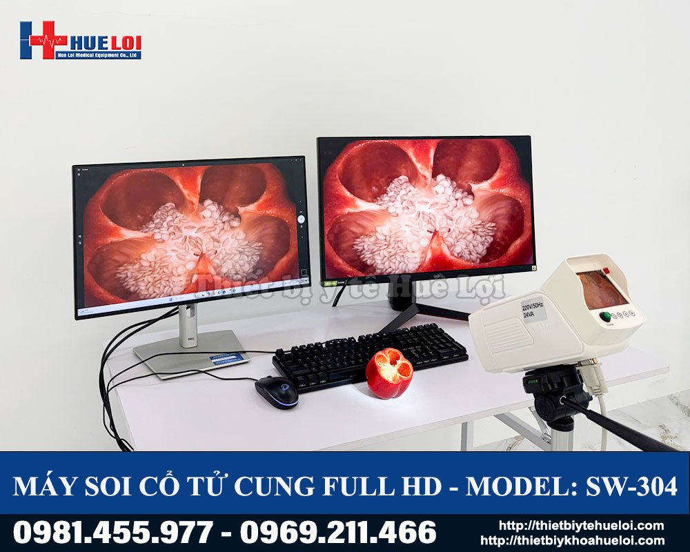 Máy soi cổ tử cung Full HD SW-304 Sanwe Medical